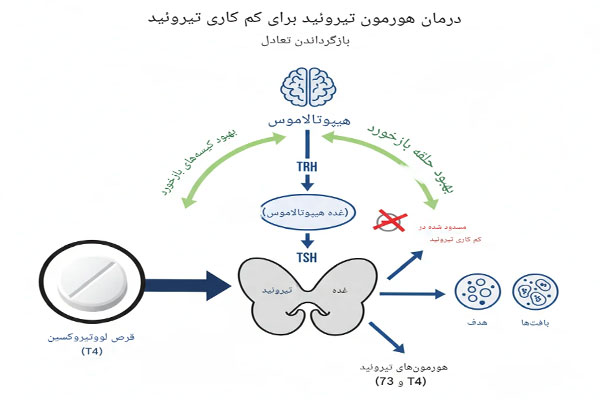 کم کاری تیروئید
