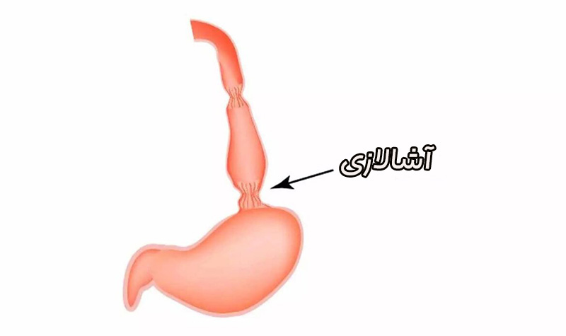آشالازی
