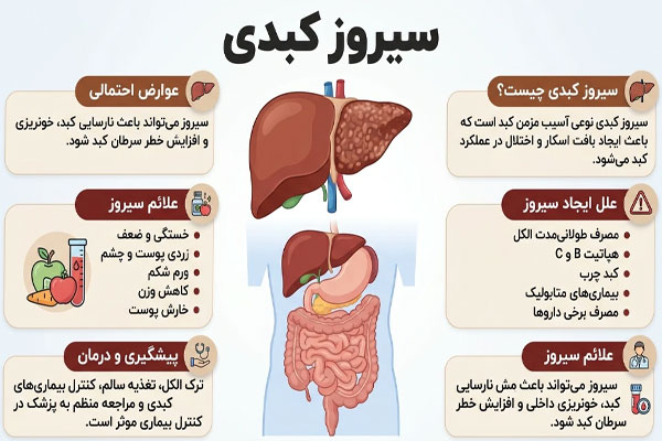 سیروز کبدی