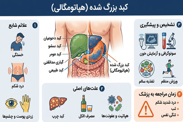  هپاتومگالی