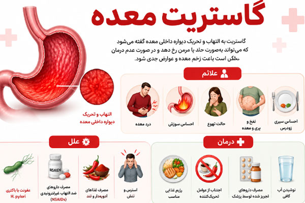 1358 گاستریت معده