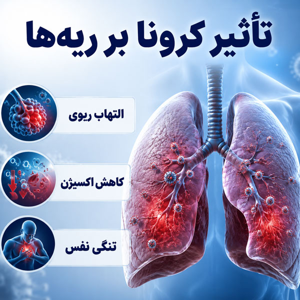 4688 تاثیر کرونا بر ریه