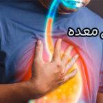 رفلاکس معده