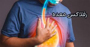 رفلاکس معده