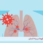 تاثیر کرونا بر ریه انسان