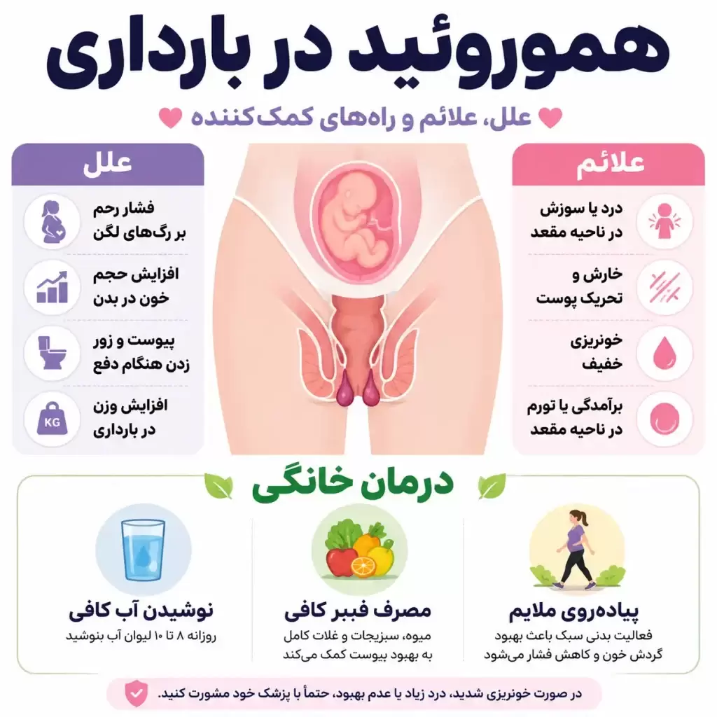 هموروئید بارداری-optimized بواسیر در بارداری