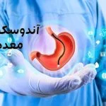 آندوسکوپی معده