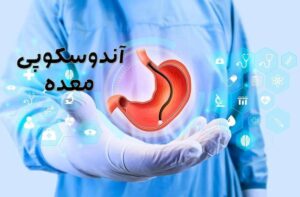 آندوسکوپی معده