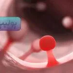 پولیپ روده