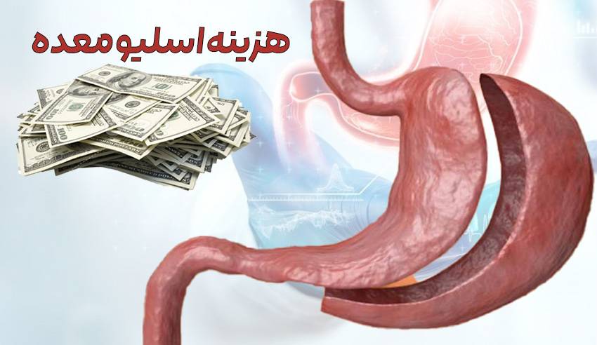 هزینه اسلیو معده