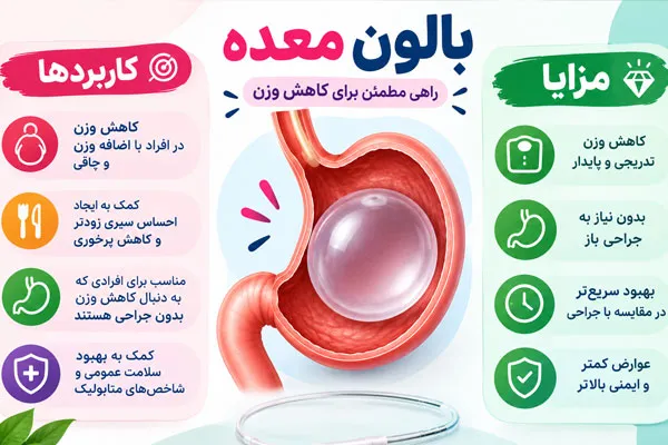 بالون معده