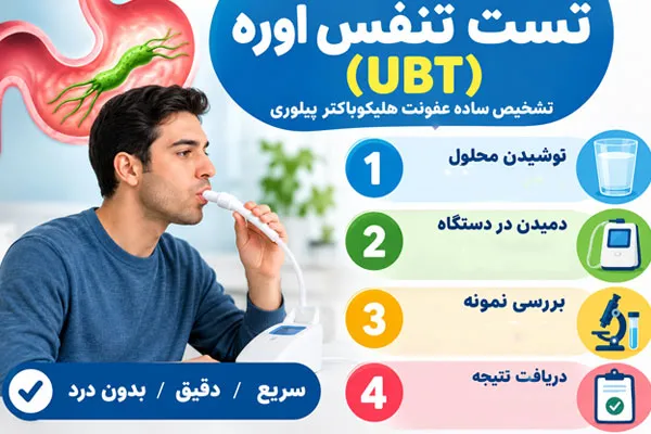 تست-اوره تست اوره