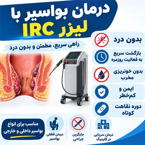 درمان هموروئید با IRC