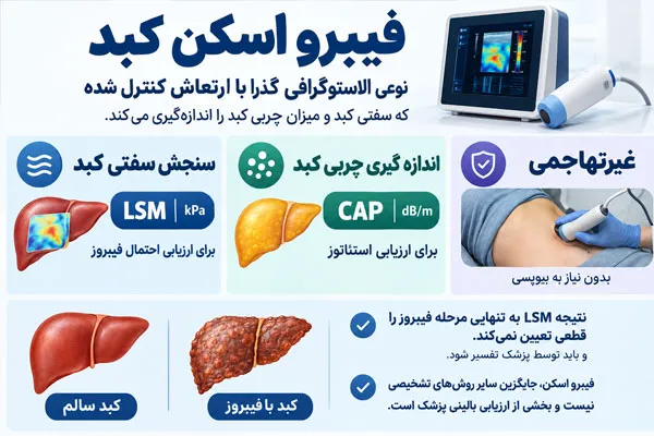 فیبرو اسکن