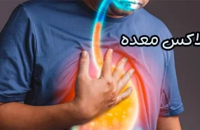 رفلاکس معده