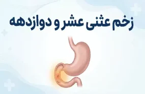 زخم دوازدهه