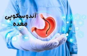 آندوسکوپی معده