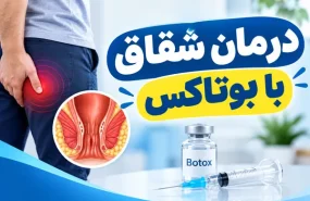 درمان شقاق